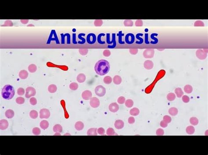 What is Anisocytosis and Microcytosis?